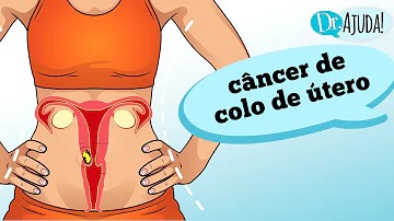 cancer de colo do utero vacina diminui risco de contrair a doenca whatsapp image 2022 02 17 at 01.15.28