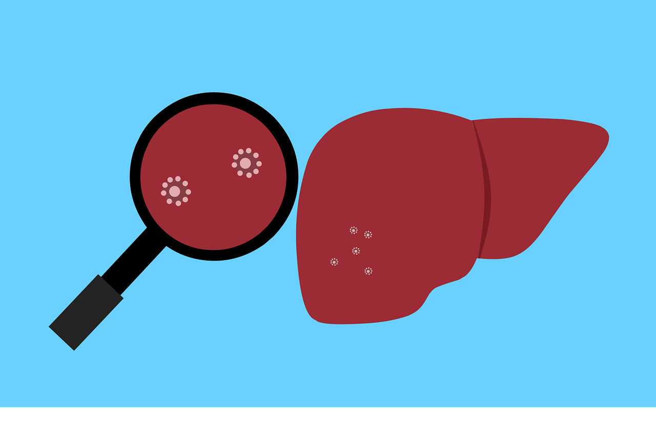 caso suspeito de hepatite de etiologia desconhecida e registrado em sc liver g9032f8e92 1280