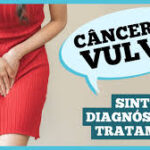 ja ouviu falar de cancer de vulva caroco coceira e feridas podem ser sintomas transferir 48