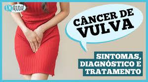 ja ouviu falar de cancer de vulva caroco coceira e feridas podem ser sintomas transferir 48